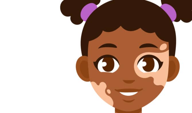 These Dolls With Skin Conditions Celebrate Our Differences