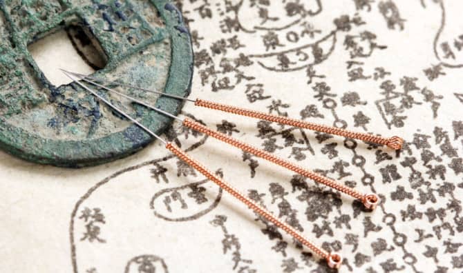 Acupuncture 101: What it is and How it Works