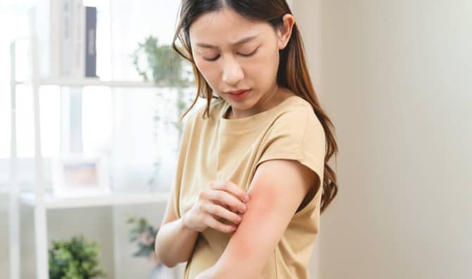 New Treatment Could Get the Itch Out