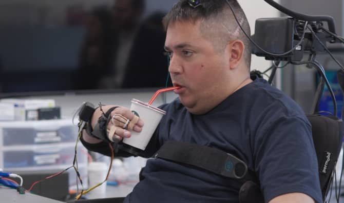 An Innovative  Procedure is Restoring Touch to People Who are Paralyzed