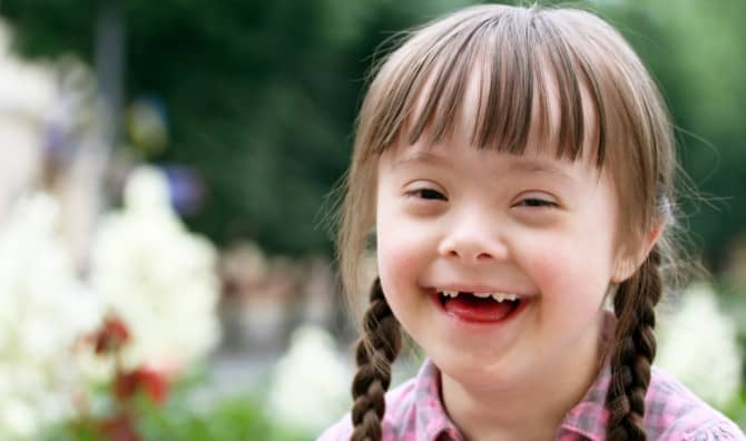 Watch How Special Kids are Changing the Face of Beauty [VIDEO]