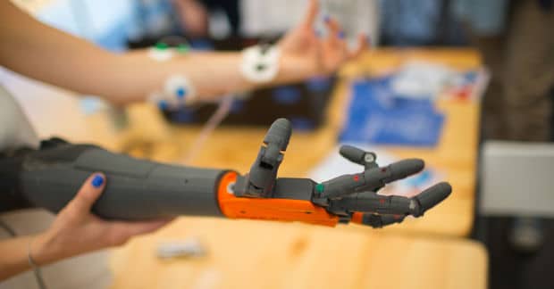 How an Uber Driver Found New Hands for His Daughter