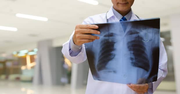 Science Can Now Grow Healthy Lung Tissue From Stem Cells