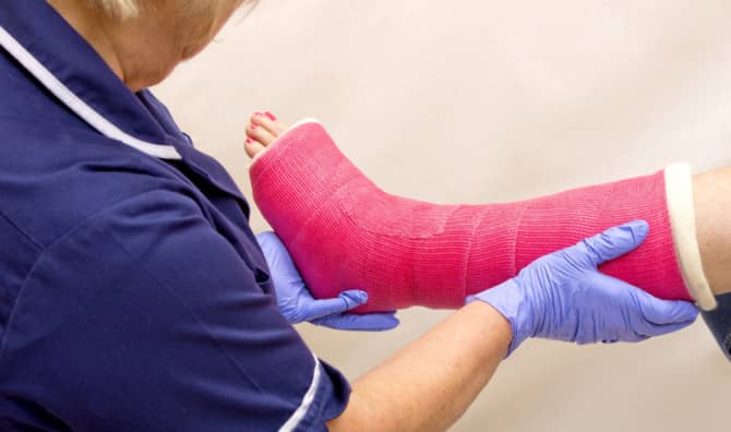 New Bandage Helps Heal Broken Bones