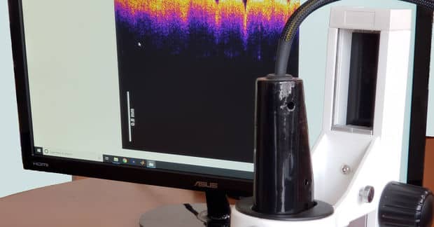 This Virtual Biopsy Device Can Detect Skin Cancer Painlessly