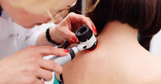 Israeli Scientists Are Developing a Nano-Vaccine Against Melanoma