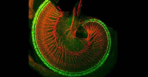 Scientists Found Proteins that Could Restore ‘Irreversible’ Hearing Loss