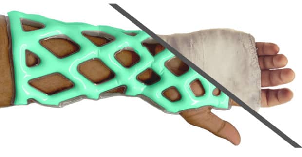 New Cast is Waterproof, Breathable, and Totally Itch-Free