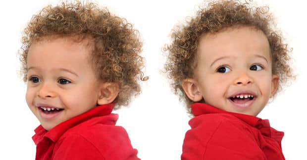 Saudi Surgeon Separates His 48th Set of Conjoined Twins