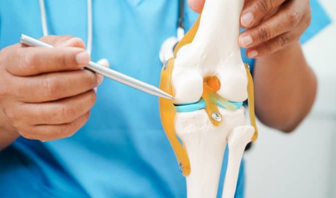 Model of a knee with osteoarthritis.