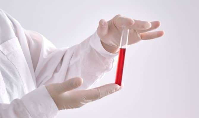 FDA Approves First Blood Test That Could Diagnose Alzheimer’s Disease