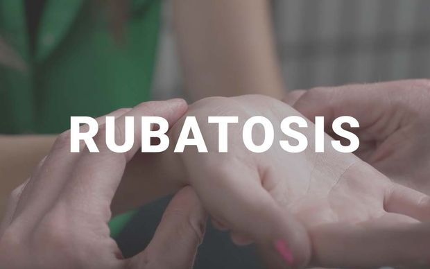 A close-up of one person's fingers gently pressing on another person's inner wrist, as if feeling for a pulse, with the word 'RUBATOSIS' displayed in large white capital letters across the center of the image.