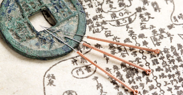Acupuncture